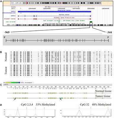 Hypermethylation of DHRS3 as a Novel Tumor Suppressor Involved in Tumor Growth and Prognosis in Gastric Cancer